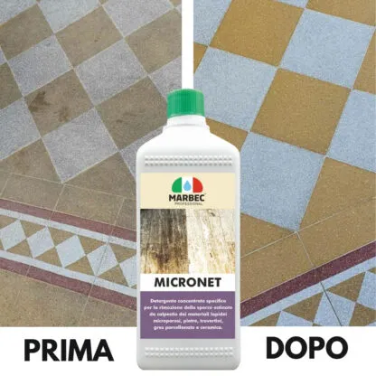 MICRONET