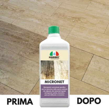 MICRONET