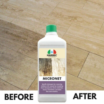 MICRONET