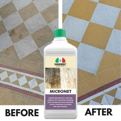 MICRONET