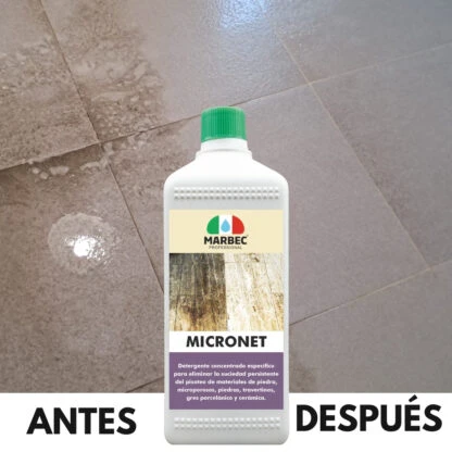 MICRONET