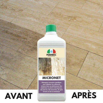 MICRONET