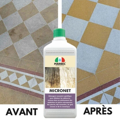 MICRONET